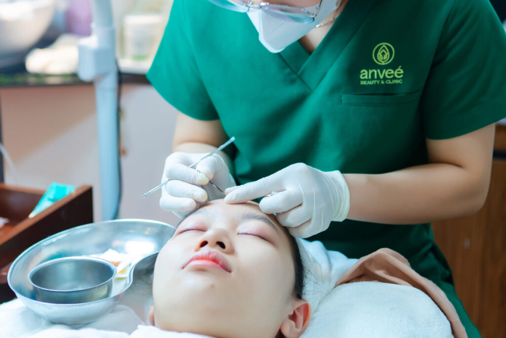 tri-mun-biolight-acnes-tai-tham-my-anvee