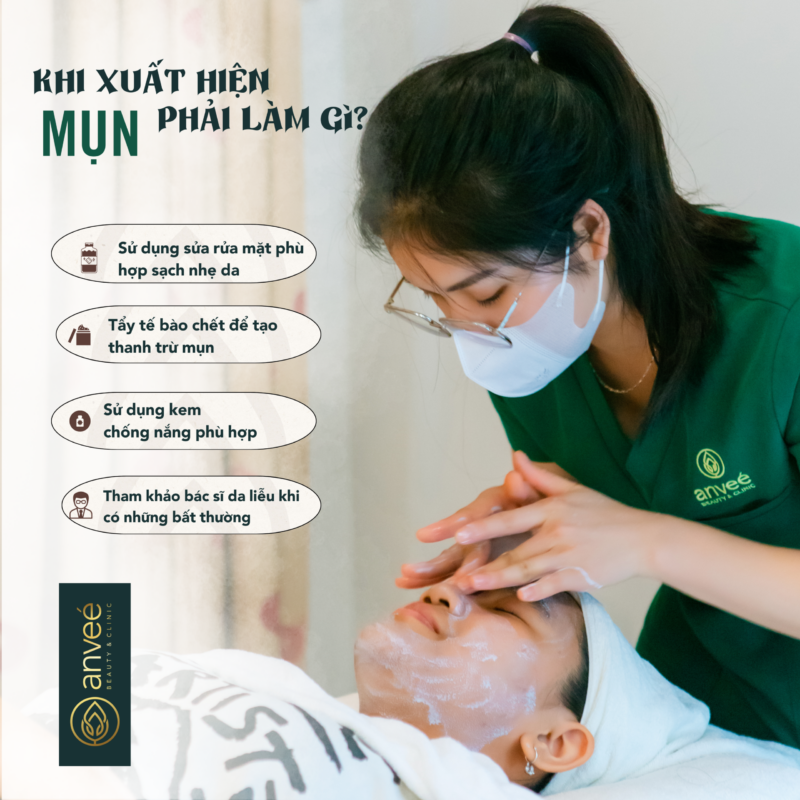 phải làm gì khi mụn xuất hiện