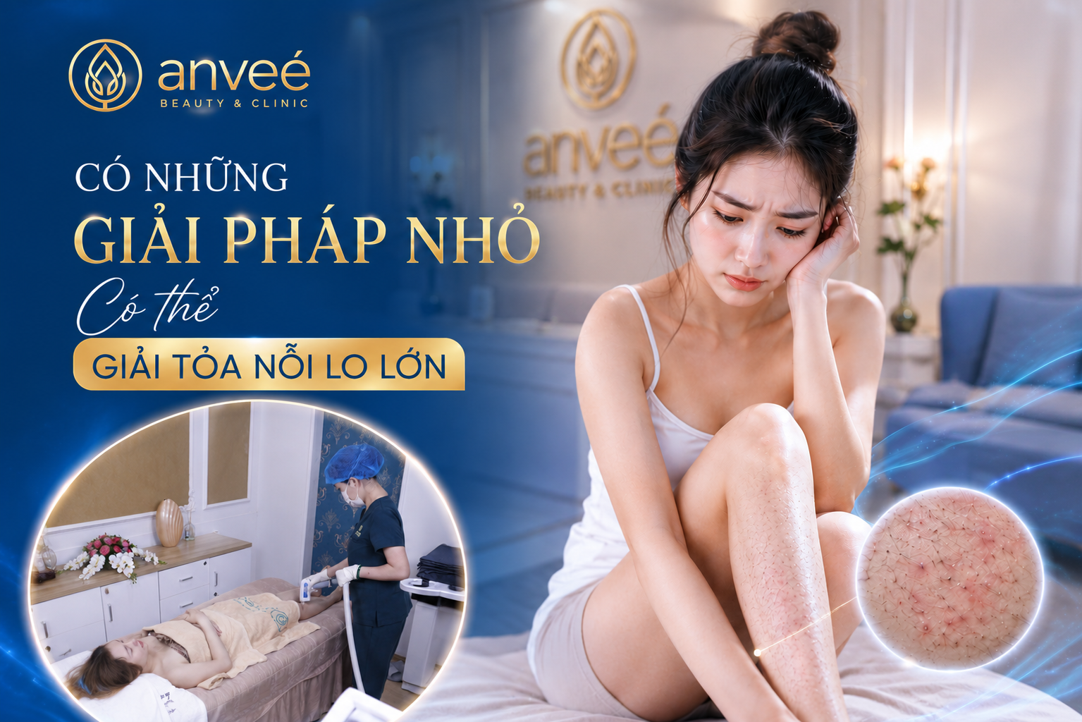 viêm nang lông